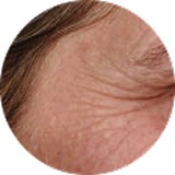 Fine Lines<br />
and<br />
Wrinkles