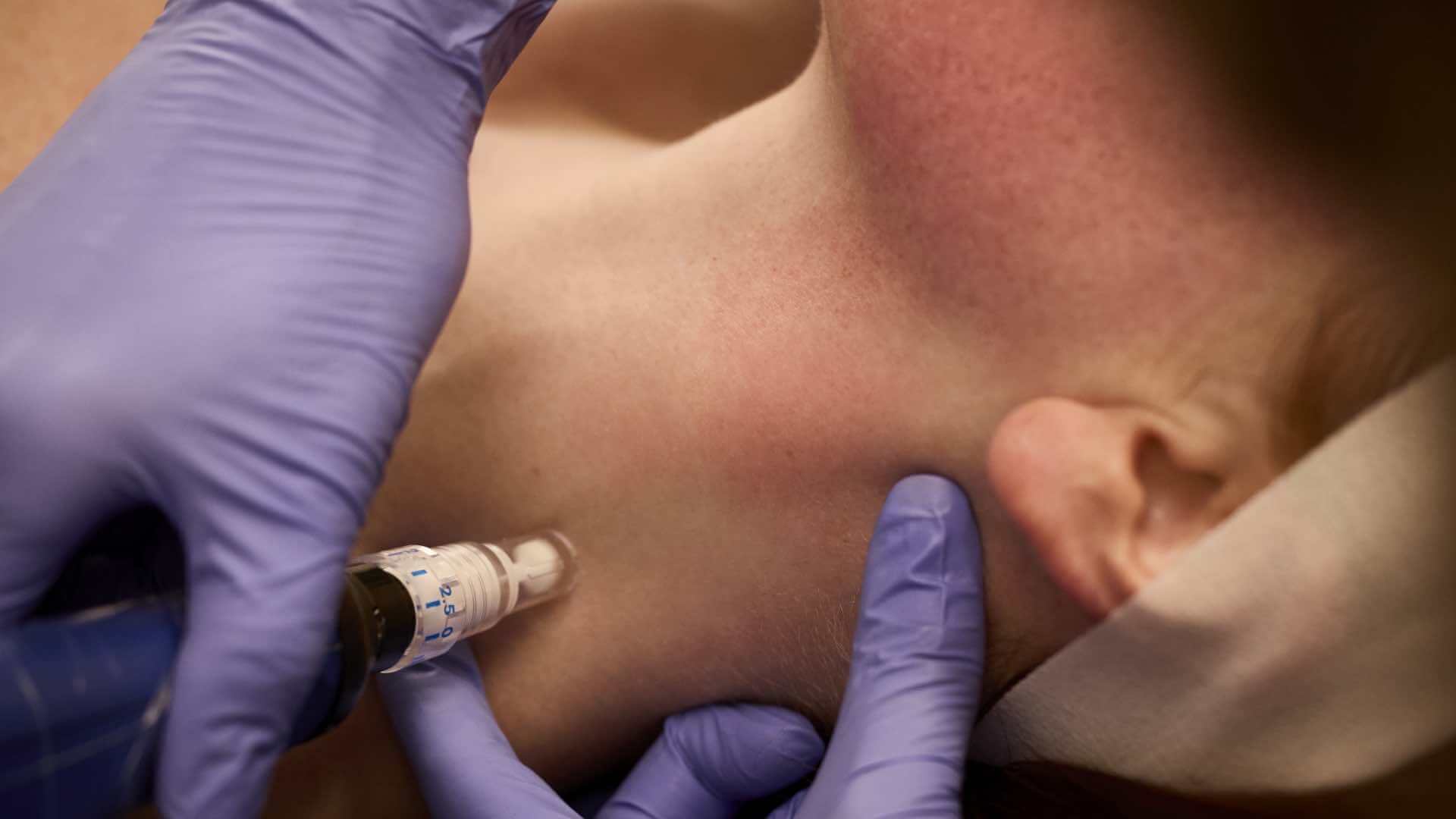Improve the appearance of neck <em>wrinkles</em>